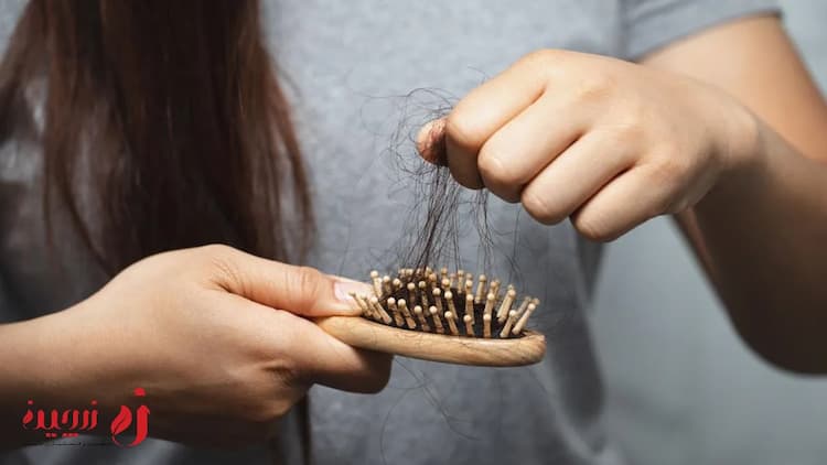 آیا تغذیه بر ریزش مو تاثیر می‌گذارد؟