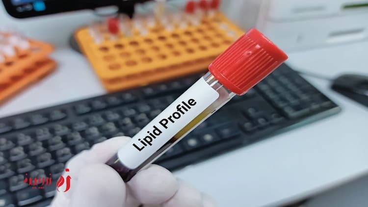 چربی خون بالا چیست؟ چگونه از عواقب مرگبار آن جلوگیری کنیم؟