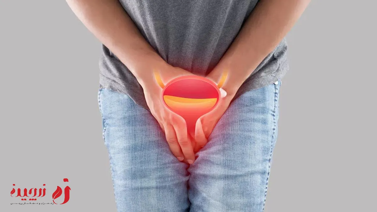 تکرر ادرار چیست؟ | برای کنترل ادرار مکرر چی بخوریم؟